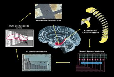 Brain Chips